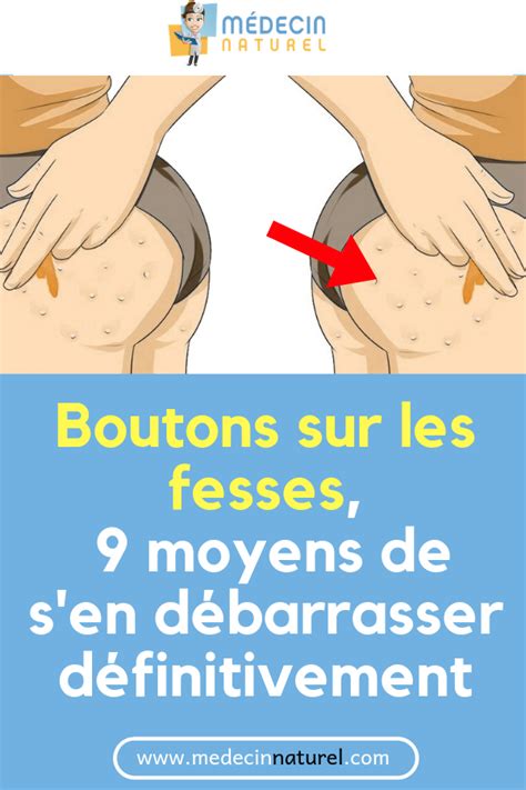 Boutons sur les fesses : comment sen débarrasser